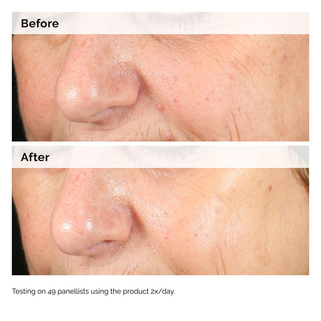 The Ordinary Alpha Arbutin 2 - HA Jasmine Beauty